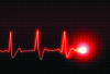 heart_beat_monitor_line